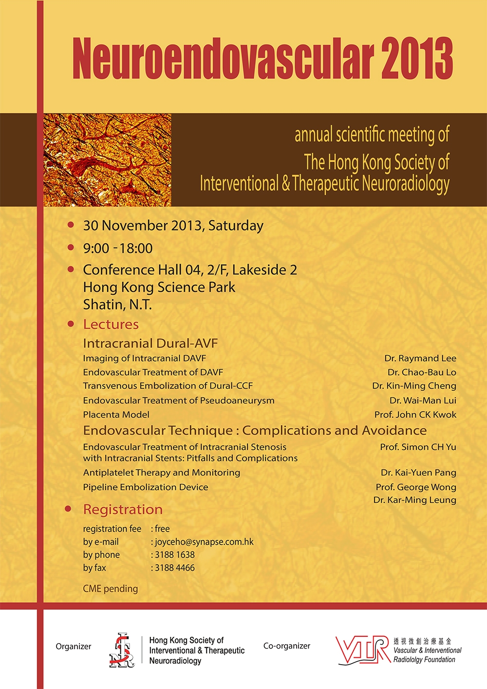 本頁圖片/檔案 - Neurovascular-2013-Poster-2013-11-20
